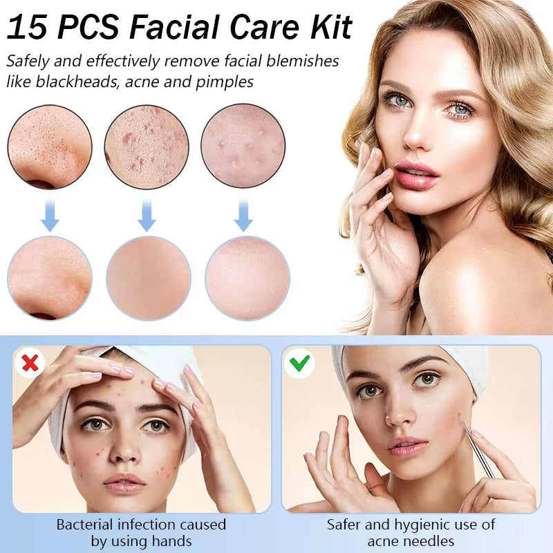 🧼 Profesionalni alat za uklanjanje mitesera – sigurno rješenje za čistu kožu