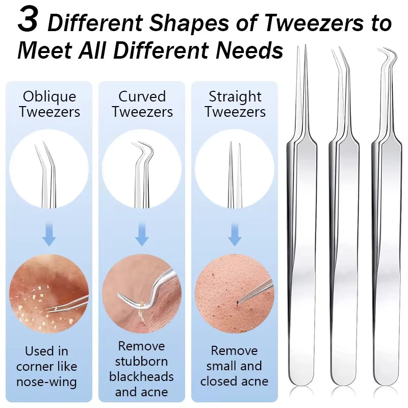 🧼 Profesionalni alat za uklanjanje mitesera – sigurno rješenje za čistu kožu