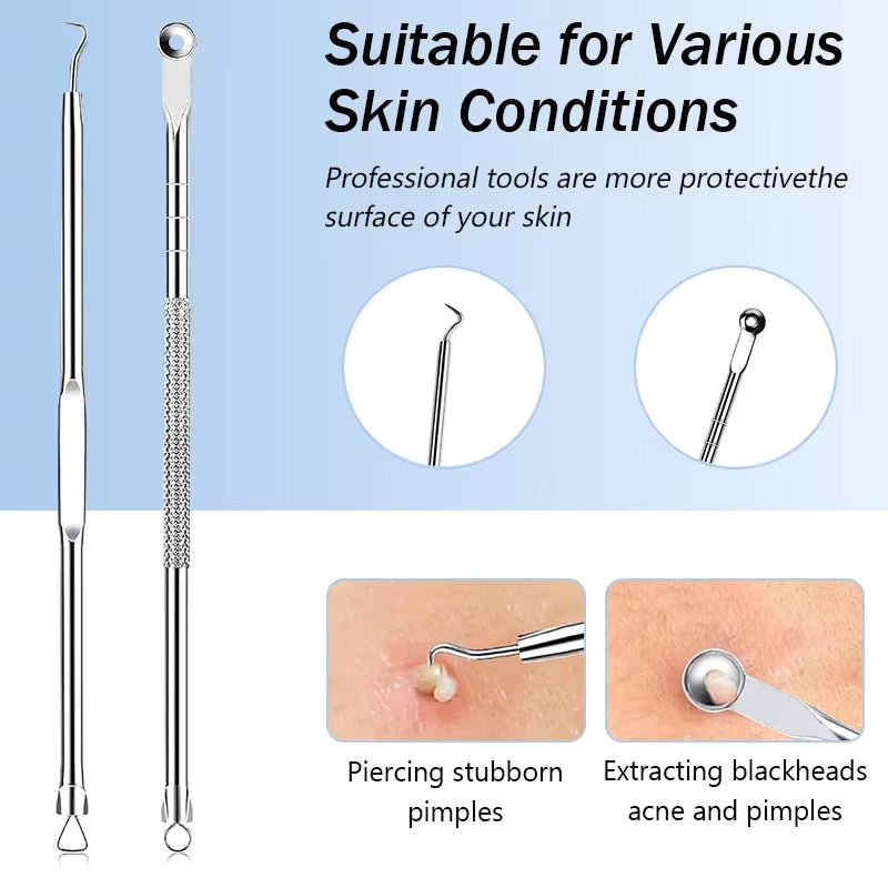 🧼 Profesionalni alat za uklanjanje mitesera – sigurno rješenje za čistu kožu